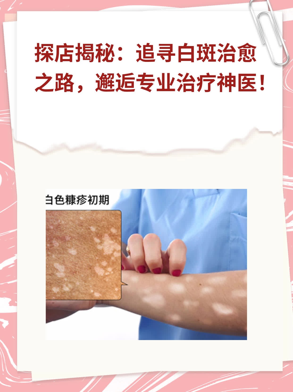 科技之光重塑肌肤之美，最新白斑治疗方法揭秘