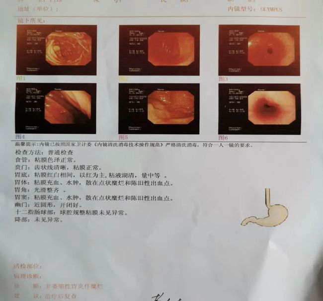 科技重塑医疗体验，最新胃镜做法开启智能探秘之旅