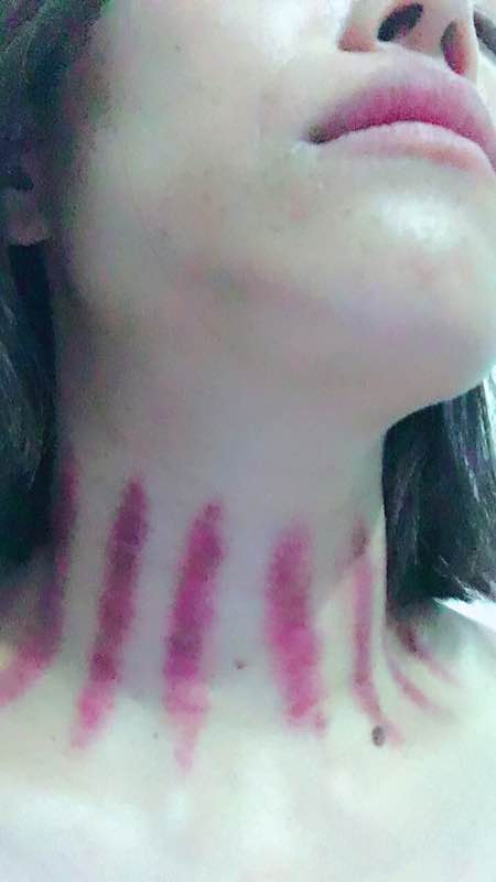 赛场上的欢笑与友情，比赛揪痧相册回顾